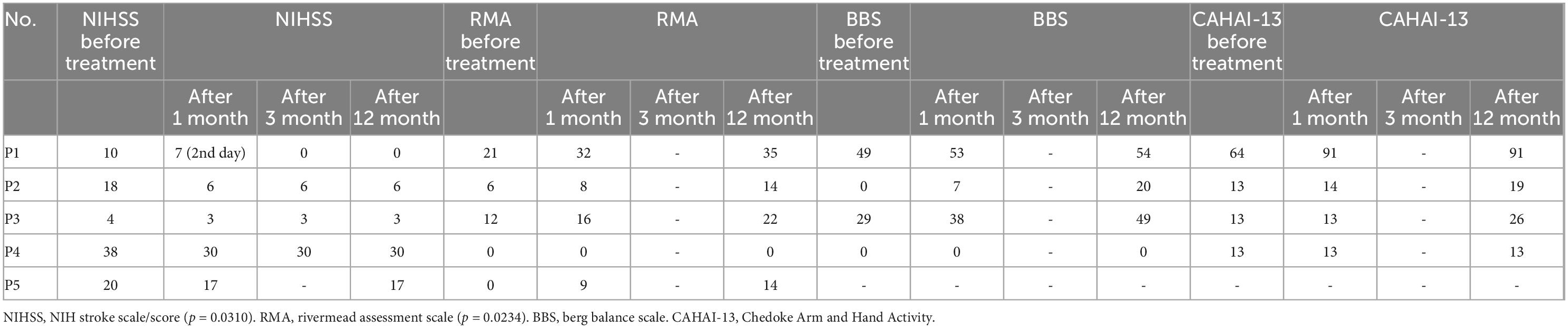 臍帶間充質(zhì)干細(xì)胞 (UC-MSC) 治療后中風(fēng)康復(fù)的結(jié)果測量 臍帶間充質(zhì)干細(xì)胞 (UC-MSC) 治療后中風(fēng)康復(fù)的結(jié)果測量