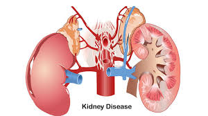 減輕負(fù)擔(dān),延長生命:干細(xì)胞療法對降低腎病透析并發(fā)癥的影響評估 減輕負(fù)擔(dān),延長生命:干細(xì)胞療法對降低腎病透析并發(fā)癥的影響評估