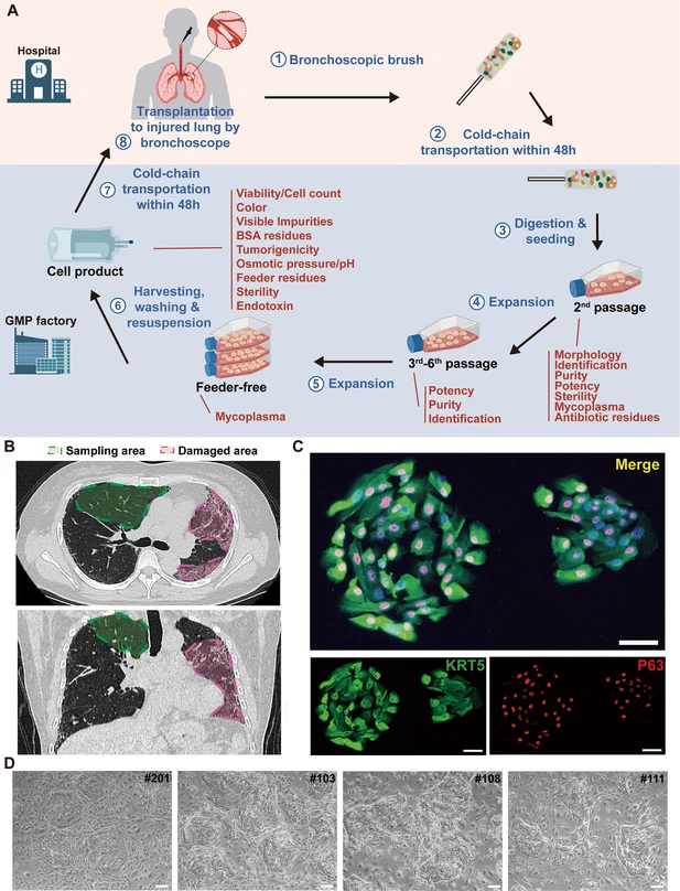 圖1：從IPF患者中分離的P63+肺祖細(xì)胞的克隆和表征。