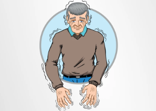 從短期緩解到長期穩(wěn)定：干細(xì)胞移植治療帕金森病的療效持續(xù)時(shí)間研究