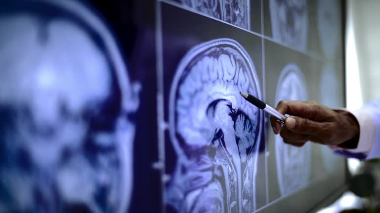 綜述：談?wù)勯g充質(zhì)干細(xì)胞治療中風(fēng)的機(jī)制、案例及未來發(fā)展方向