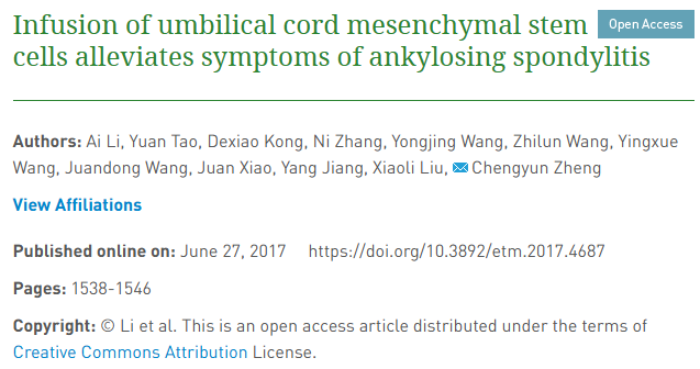 輸注臍帶間充質干細胞可緩解強直性脊柱炎癥狀