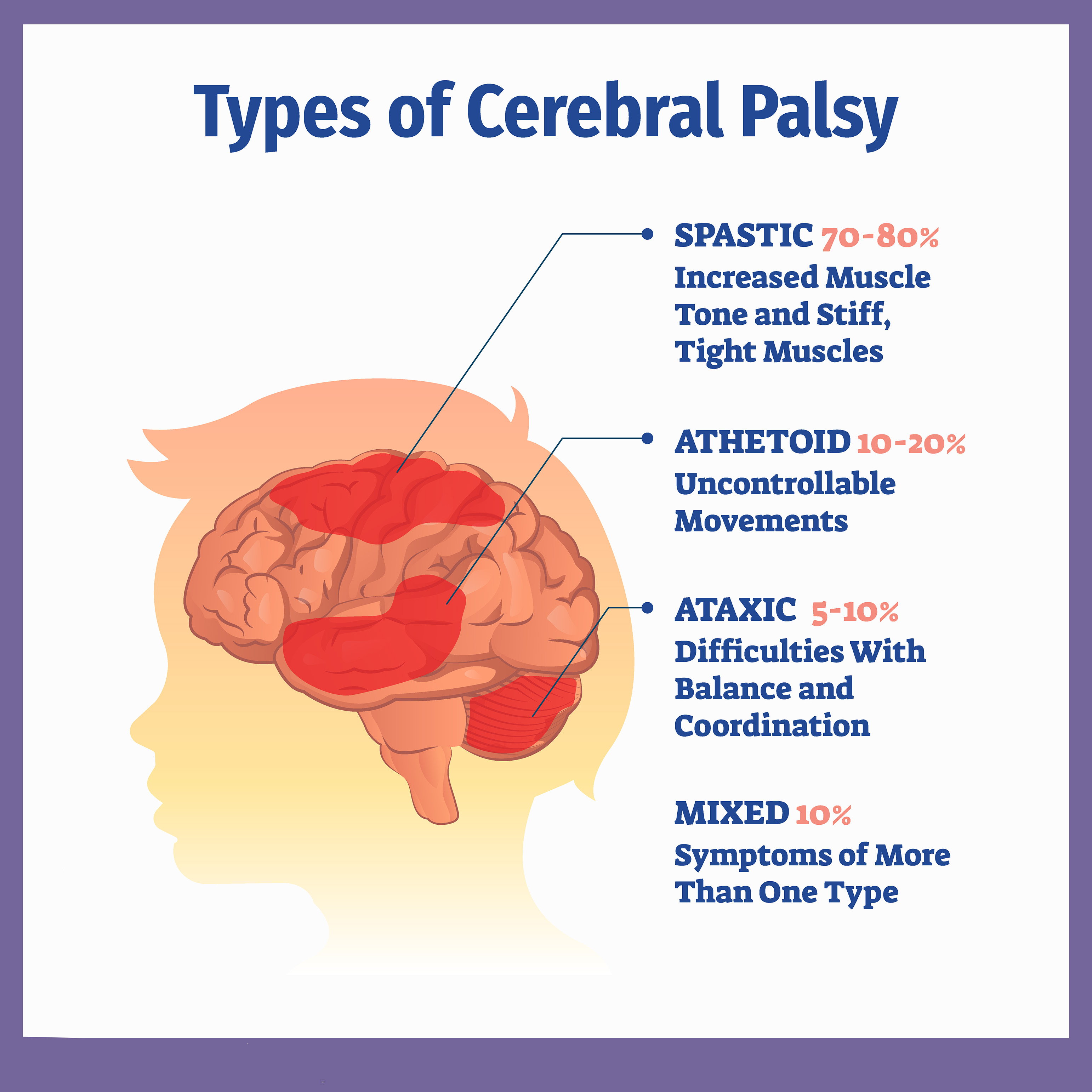 低劑量VS高劑量：不同劑量的干細(xì)胞治療腦癱哪個(gè)更加安全？