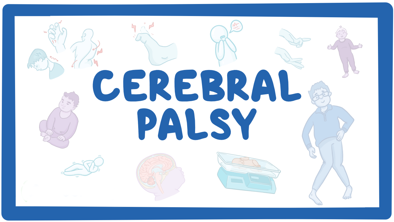 孩子腦癱有救了？神經(jīng)干細(xì)胞移植治療腦癱的真實(shí)療效分享