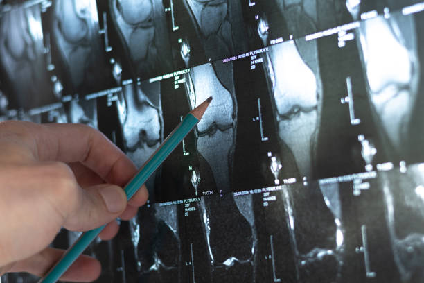 4種細(xì)胞療法運(yùn)用免疫調(diào)節(jié)和再生機(jī)制為治療骨科疾病開(kāi)辟了新方向