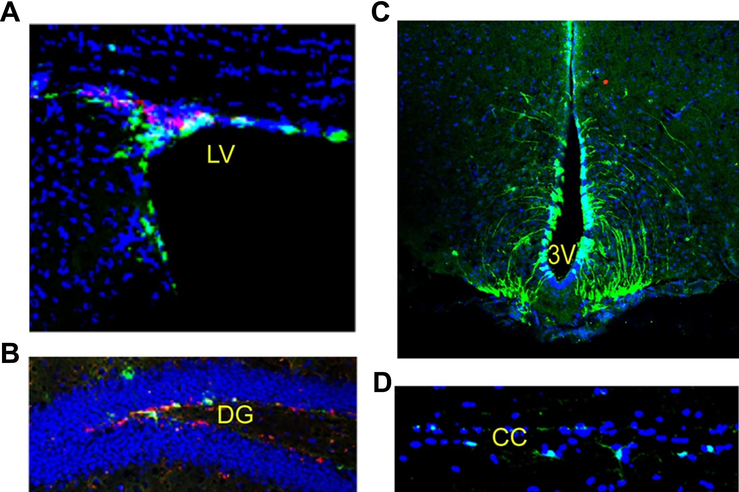 圖2：成年小鼠腦和脊髓中的神經(jīng)干細(xì)胞：左腦 (LV)、第三腦室 (DG)、齒狀回 (DG) 和脊髓。