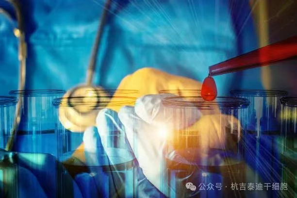 一名RA/MS患者經(jīng)過CAR-T治療失敗后，經(jīng)過自體干細胞移植后，主觀健康狀態(tài)顯著改善！