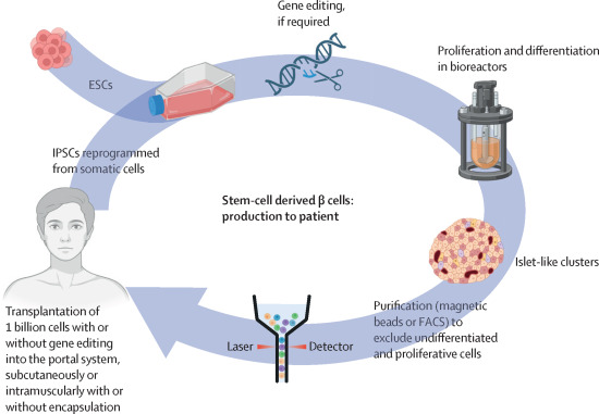 胚胎干細(xì)胞或誘導(dǎo)多能干細(xì)胞來源的β細(xì)胞的制備和移植