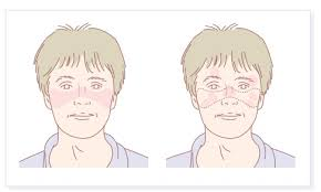 2025年1-12月干細(xì)胞治療系統(tǒng)性紅斑狼瘡匯總：多項(xiàng)臨床試驗(yàn)全面提速！