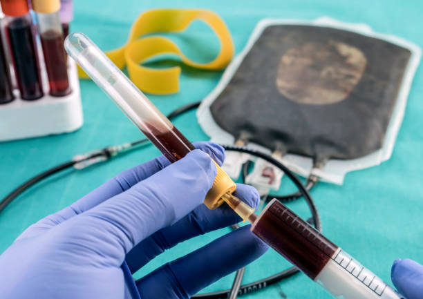 自體干細(xì)胞移植費(fèi)用及副作用:三大客觀視角下的真相 自體干細(xì)胞移植費(fèi)用及副作用:三大客觀視角下的真相