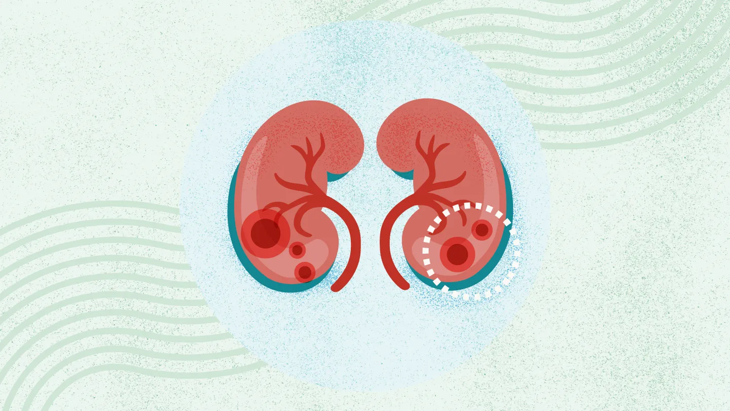 2025年國(guó)內(nèi)干細(xì)胞治療腎病的醫(yī)院都有哪幾家？