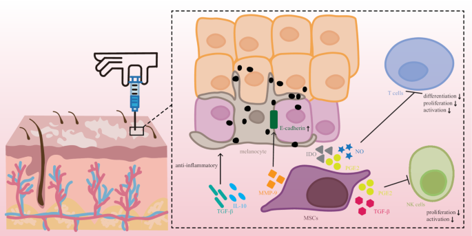 圖1：白癜風(fēng)患者皮膚注射MSCs后對(duì)局部皮膚的潛在免疫調(diào)節(jié)和抗炎作用