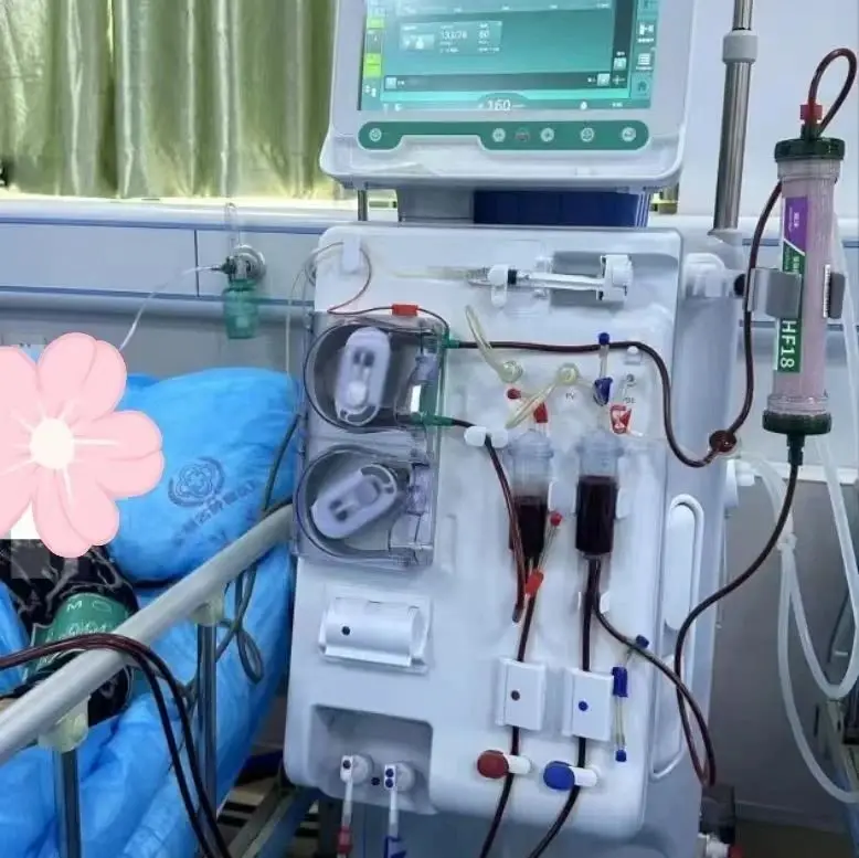 單針交互透析技術(shù)