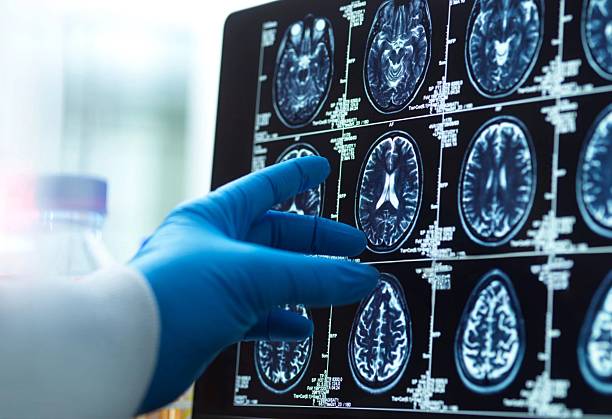 神經(jīng)干細(xì)胞移植十大常見問(wèn)題解答：從原理到術(shù)后護(hù)理全知道