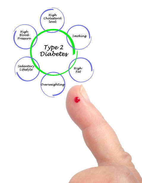 哪些人適合干細胞治療2型糖尿??？專家公布5大評估標準