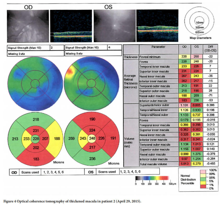 遺傳性視神經(jīng)病變臨床試驗(yàn) 遺傳性視神經(jīng)病變臨床試驗(yàn)