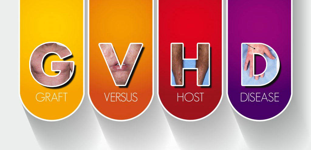 GVHD GVHD