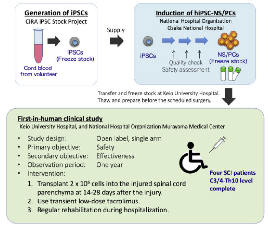 干細(xì)胞治療脊髓損傷 干細(xì)胞治療脊髓損傷