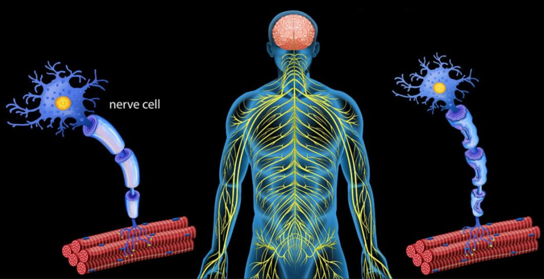 多發(fā)性硬化癥 多發(fā)性硬化癥