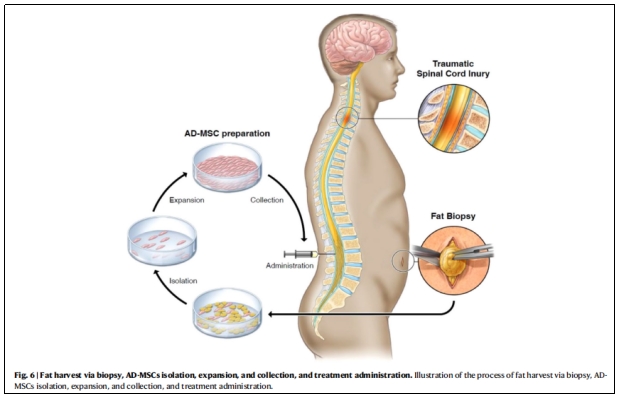 干細(xì)胞治療 干細(xì)胞治療