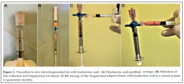 干細(xì)胞治療 干細(xì)胞治療