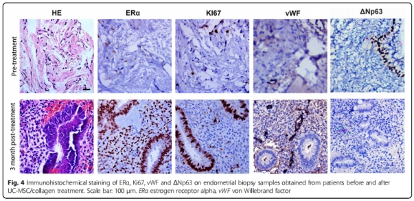 臨床試驗 臨床試驗