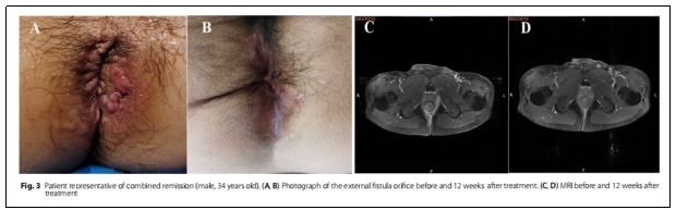 臨床試驗(yàn) 臨床試驗(yàn)