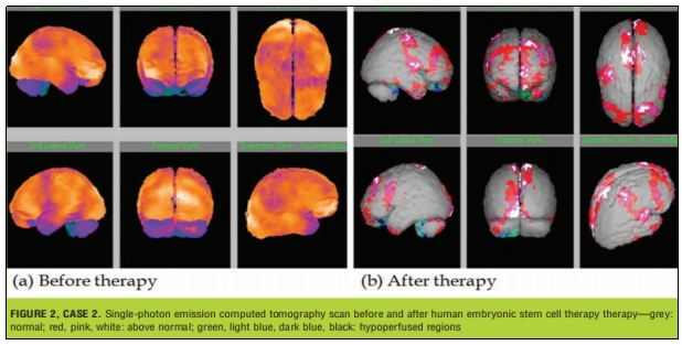 臨床試驗(yàn) 臨床試驗(yàn)
