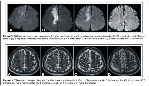 “臨床試驗”/ 臨床試驗