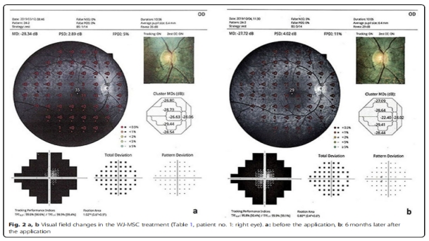 臨床試驗(yàn) 臨床試驗(yàn)