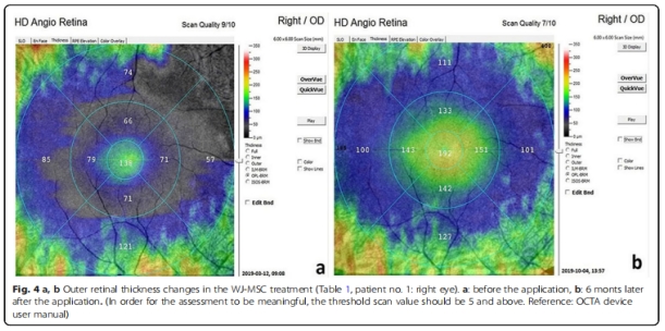 臨床試驗(yàn) 臨床試驗(yàn)