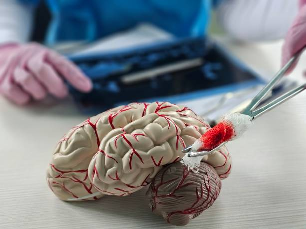 “開(kāi)關(guān)現(xiàn)象”能解決？干細(xì)胞為帕金森病治療帶來(lái)新希望