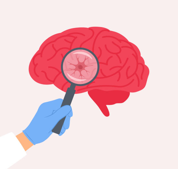 干細(xì)胞療法vs深部腦刺激：帕金森病進(jìn)階治療方案療效對比