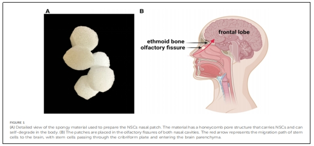 圖1：用于制備NSCs鼻貼片的海綿狀材料的詳細視圖。