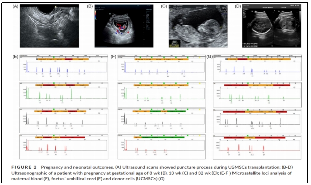 圖2：妊娠和新生兒結(jié)果。
