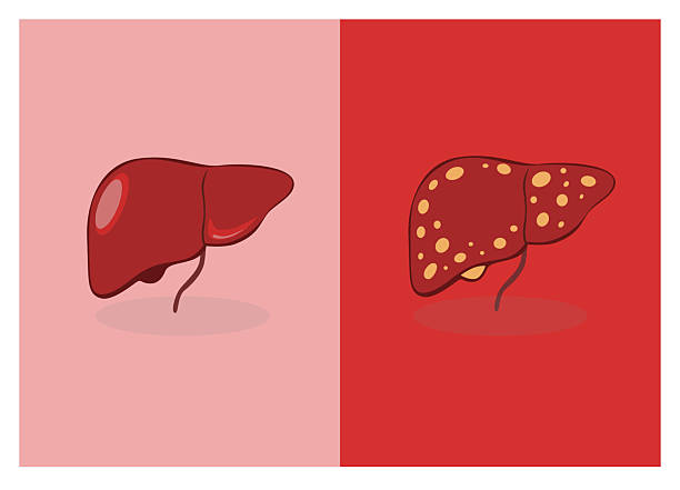 國內(nèi)外干細(xì)胞治療肝硬化進(jìn)展對比：哪項(xiàng)技術(shù)更成熟、效果更好？