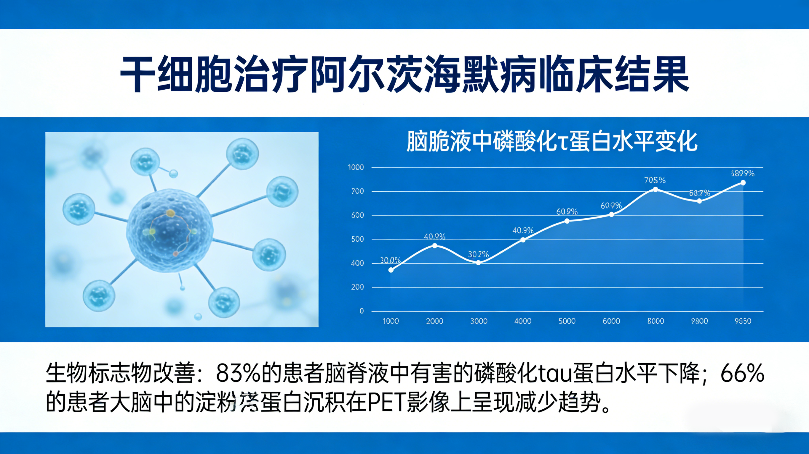 干細(xì)胞治療阿爾茨海默病臨床結(jié)果