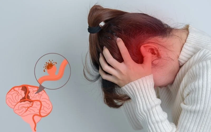 神經(jīng)干細胞移植治療腦出血：機制、療效與轉(zhuǎn)化前景