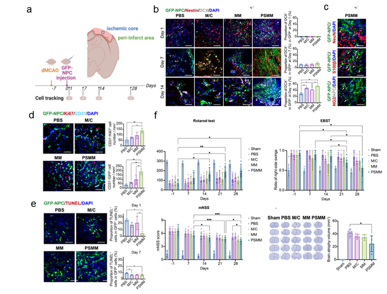 負載NPCs的PSMM-基質(zhì)復(fù)合支架促進大鼠卒中后損傷修復(fù)