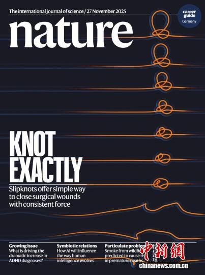 研究成果發(fā)表于國(guó)際頂級(jí)期刊《自然》并登上雜志封面。研究團(tuán)隊(duì)供圖