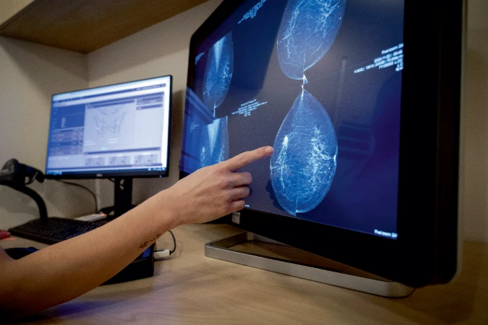 轉(zhuǎn)移性乳腺癌患者迫切需要新的治療方法。