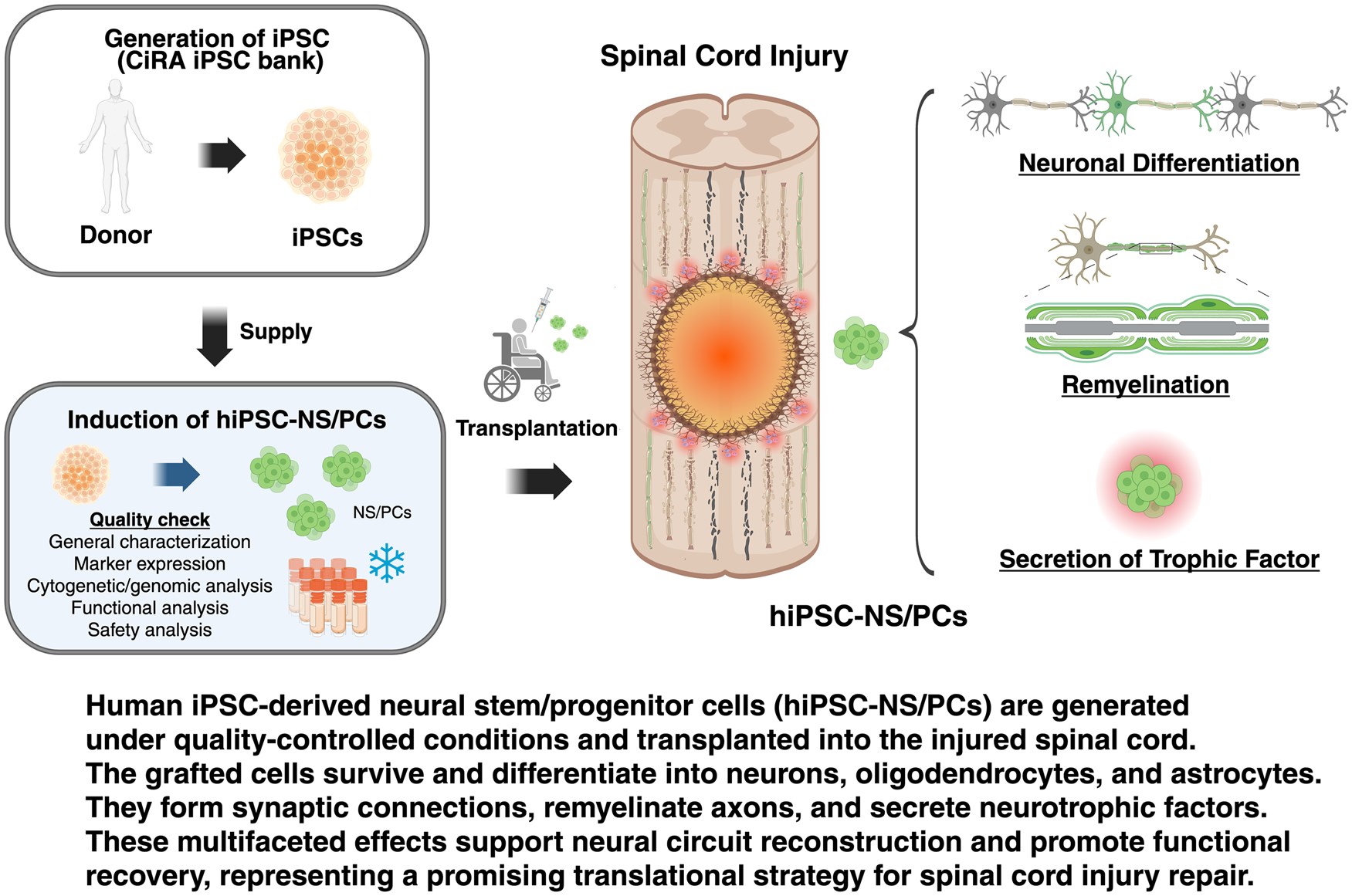 最新綜述！多能干細胞來源的神經(jīng)干/祖細胞療法治療脊髓損傷：臨床進展和轉(zhuǎn)化展望
