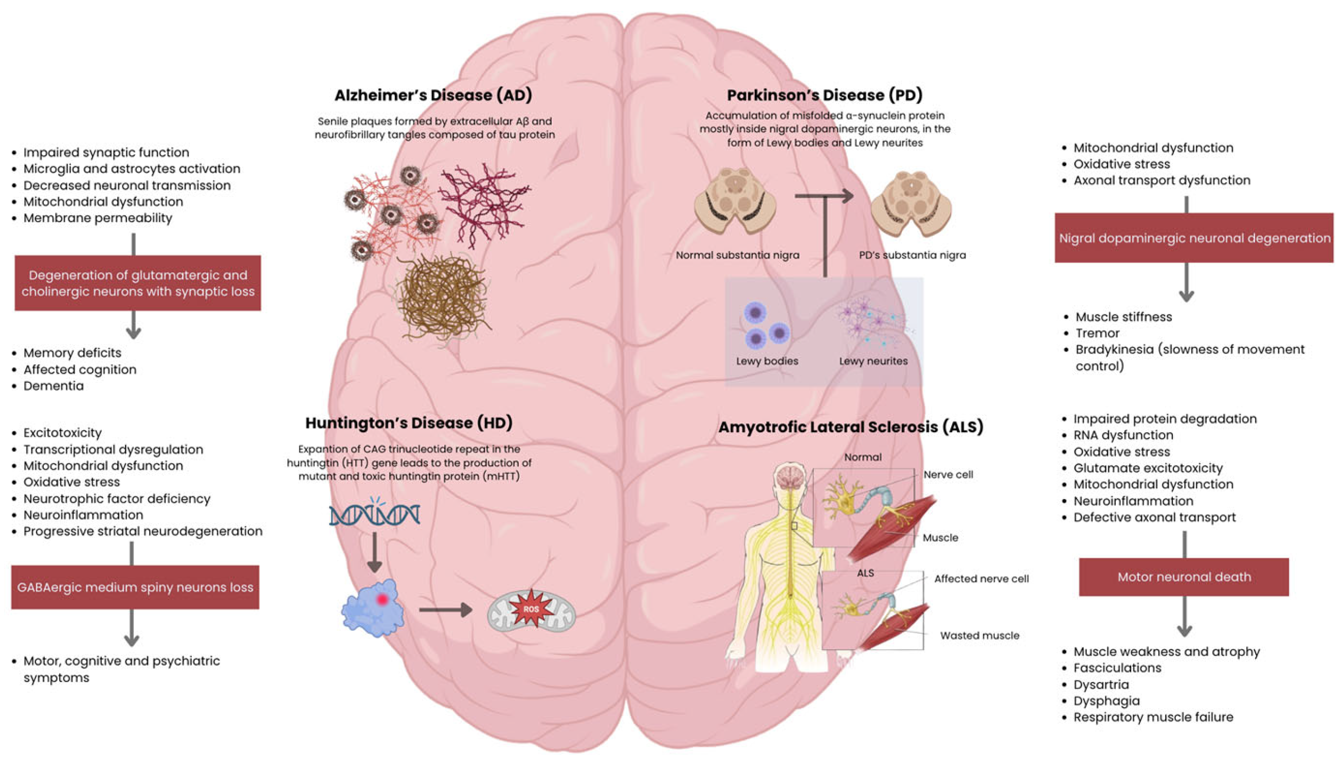圖2：主要神經(jīng)退行性疾病的病理生理機制和臨床特征。側邊欄概述了從細胞功能障礙到特定神經(jīng)元丟失以及隨后的臨床表現(xiàn)的進展過程。