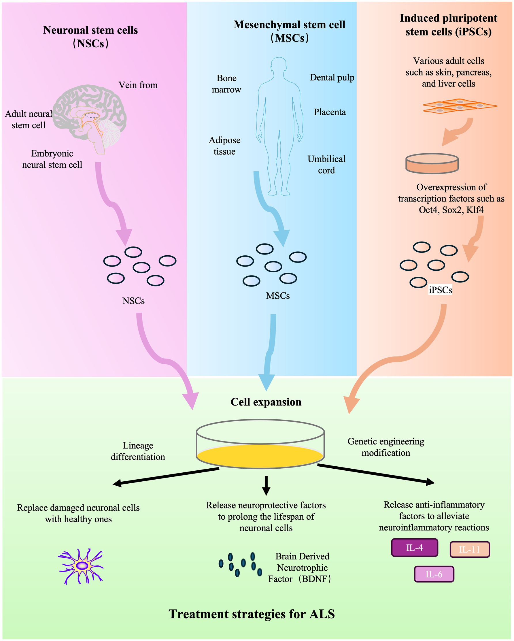 圖2：干細(xì)胞療法治療ALS的示意圖。