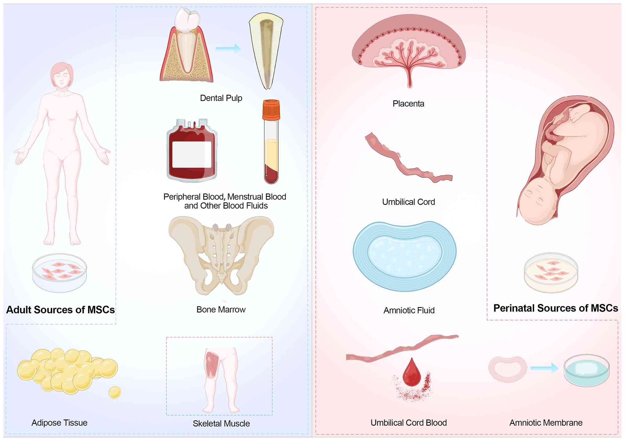 圖2：間充質(zhì)干細(xì)胞的來源。成人間充質(zhì)干細(xì)胞可來源于骨髓、脂肪組織、外周血、骨骼肌和牙髓。圍產(chǎn)期間充質(zhì)干細(xì)胞通常取自胎盤、臍帶、臍帶血、羊水和羊膜。