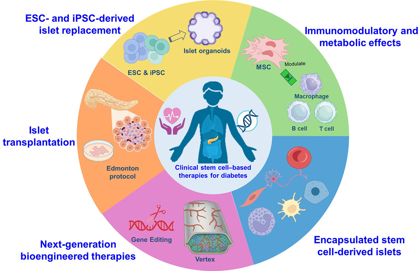 干細(xì)胞療法重塑糖尿病治療格局——主要臨床試驗(yàn)概述與未來展望